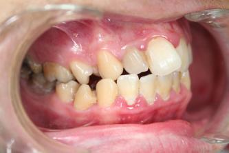 Orthodontiste Caen Orthodontiste Caen