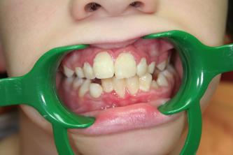 Chirurgien dentiste Caen, Mondeville Chirurgien dentiste Caen, Mondeville