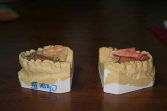appareil dentaire, orthodontiste Caen appareil dentaire, orthodontiste Caen