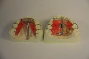 orthodontiste, appareil dentaire Caen orthodontiste, appareil dentaire Caen